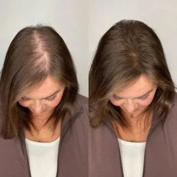 Kerarose Rosemary Hair Growth Shampoo