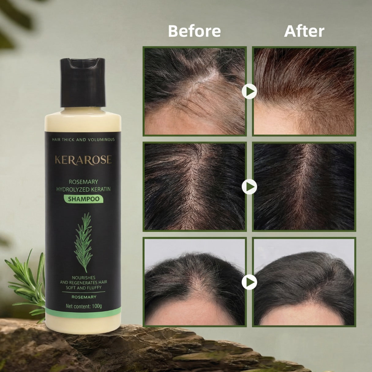 Kerarose Rosemary Hair Growth Shampoo