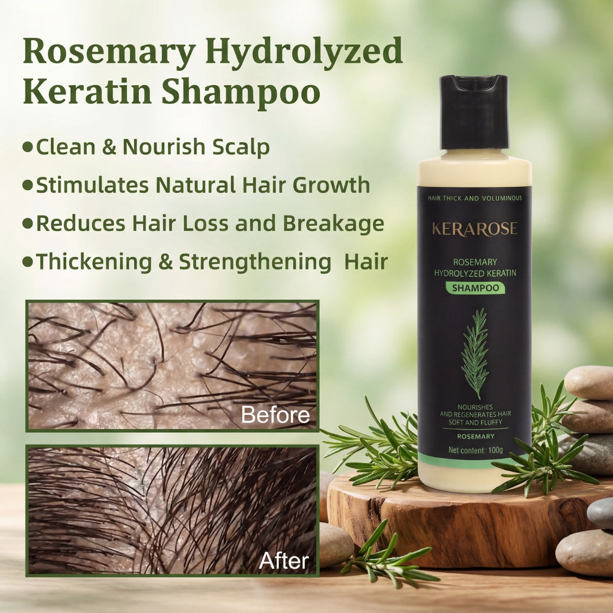 Kerarose Rosemary Hair Growth Shampoo