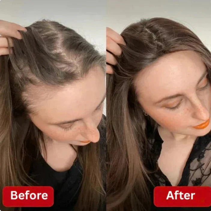 Kerarose Rosemary Hair Growth Shampoo